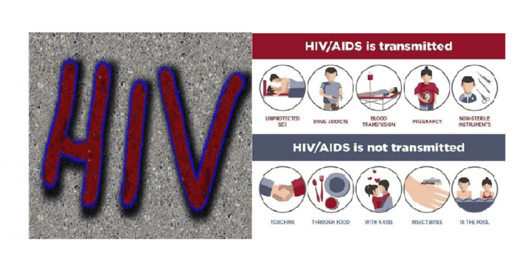 AIDS Review: What You Need to Know Before You Shop